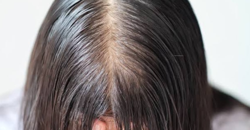Combat oily scalp